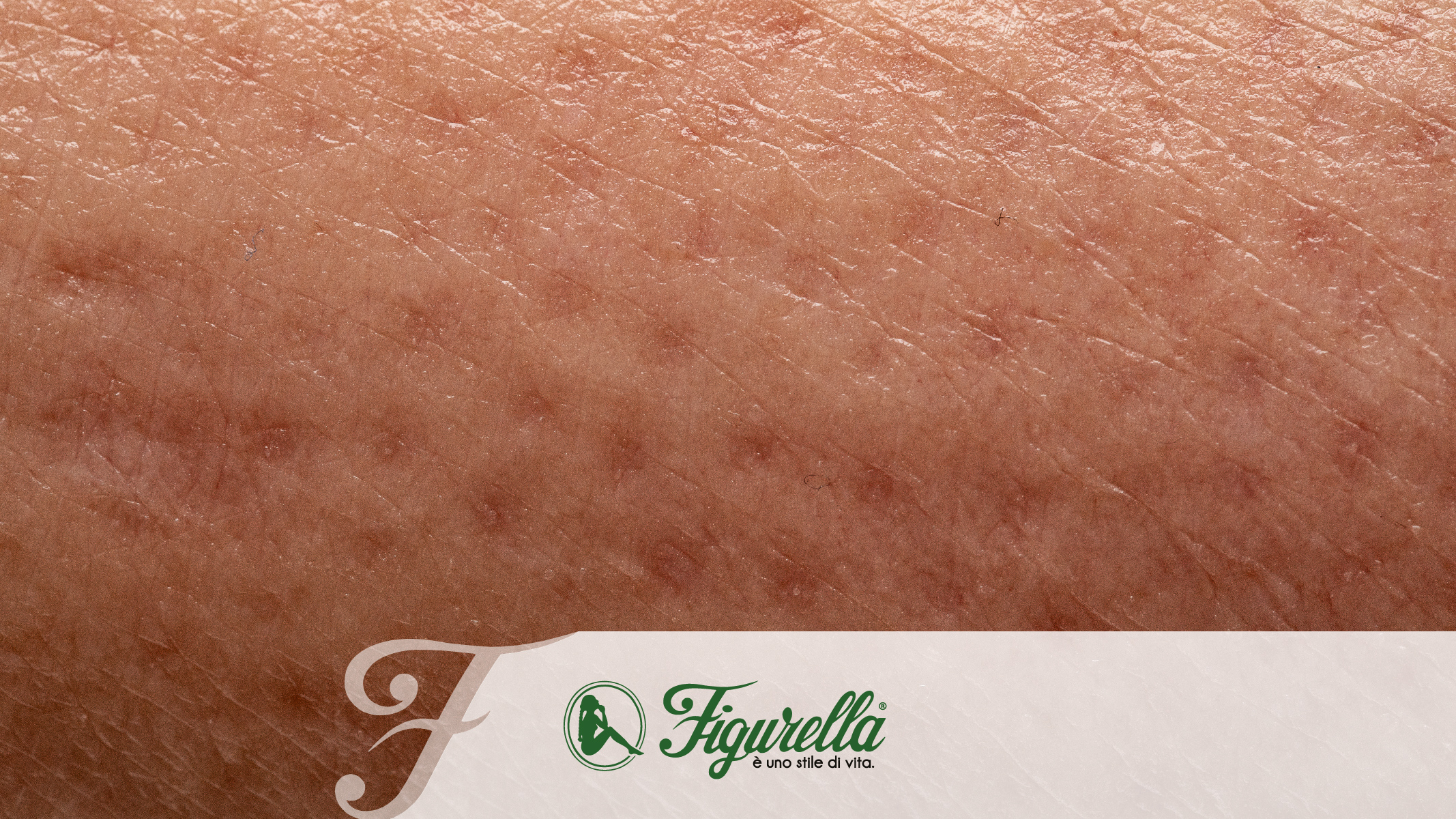 Ritenzione Idrica Pelle Buccia di Arancia